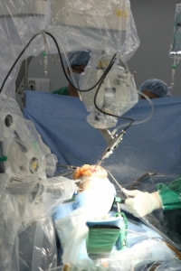 Precise and Accurate Surgery With Robodoc