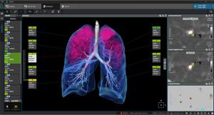 CorelineSoft Expands AI Diagnostic Solutions Across Europe's Lung Cancer Battlefront