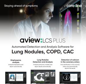 World Cancer Day on February 4 Highlights the Role of AI in Early Cancer Detection