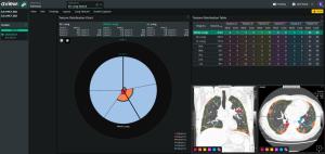 Coreline Soft Supplies AI Lung Analysis Software to Boehringer Ingelheim Taiwan
