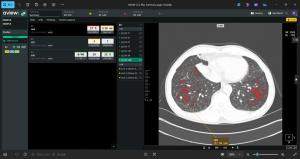 Coreline Soft Expands AI Solutions to Baylor College of Medicine