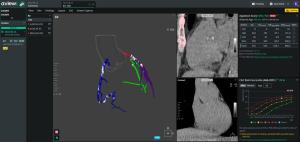 Coreline Soft’s 'AVIEW CAC' Recognized as Innovative by Korean Government