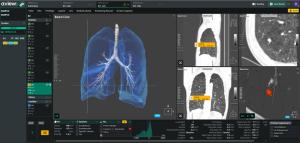 Coreline Soft: Fortune Korea’s Top 40 Promising U.S. Healthcare Innovators