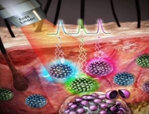 [Kim Su-dong's Science Story] Attracting cancer cells by using innocuous gold or silver nanoparticles